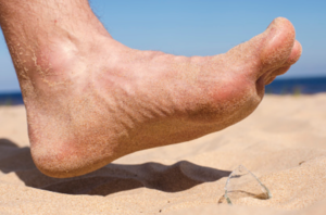 Diabetic Peripheral Neuropathy (DPN)