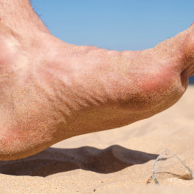 Diabetic Peripheral Neuropathy (DPN)